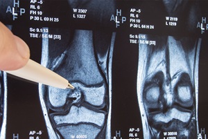 Orthopaedic Hip Consultation