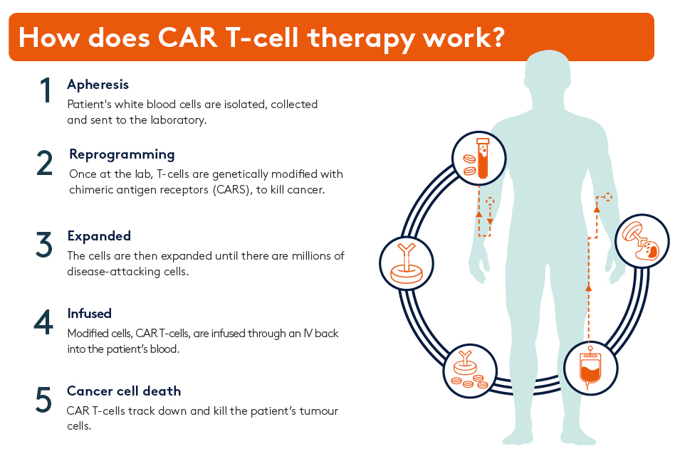 Car T Cell Therapy Hca Uk